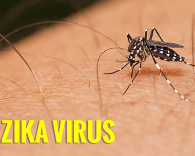 Virus Zika Những Điều Cần Biết
